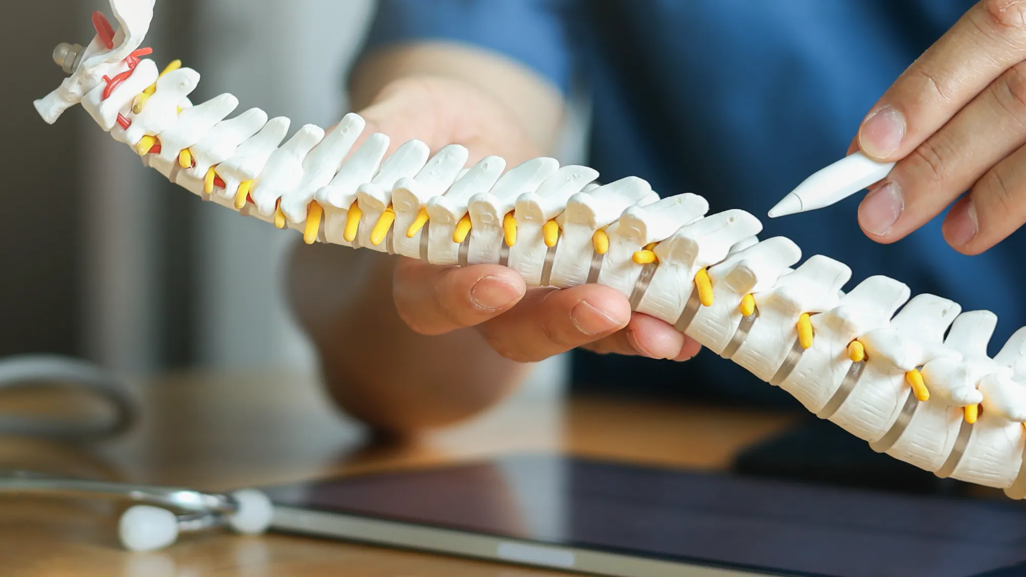 A healthcare professional uses a white stylus to point out an area on a detailed anatomical model of the spine, showing white vertebrae and yellow nerves.